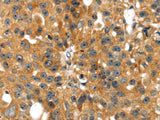 SMYD4 Polyclonal Antibody