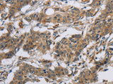 SYN2 Polyclonal Antibody