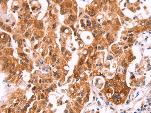 NCEH1 Polyclonal Antibody Store at -20°C