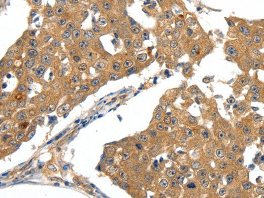 SCN5A Polyclonal Antibody
