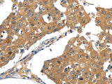 SCN5A Polyclonal Antibody