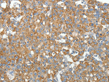 GEMIN2 Polyclonal Antibody Store at -20°C