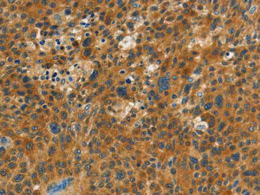 NPAP1 Polyclonal Antibody Store at -20°C