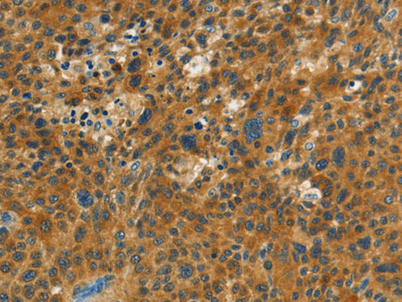 NPAP1 Polyclonal Antibody Store at -20°C
