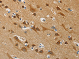 ATG4B Polyclonal Antibody Host Rabbit