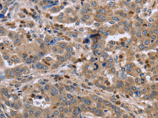 EDA Polyclonal Antibody Store at -20°C