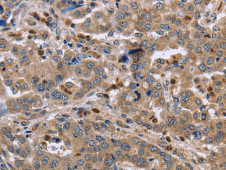 EDA Polyclonal Antibody Store at -20°C