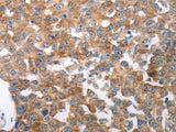 NQO2 Polyclonal Antibody Store at -20°C
