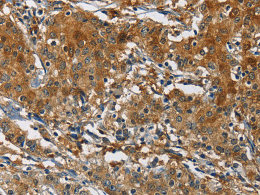 CAST Polyclonal Antibody Store at -20°C