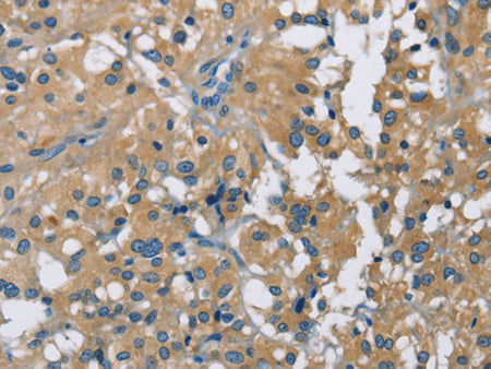 CAB39L Polyclonal Antibody Store at -20°C