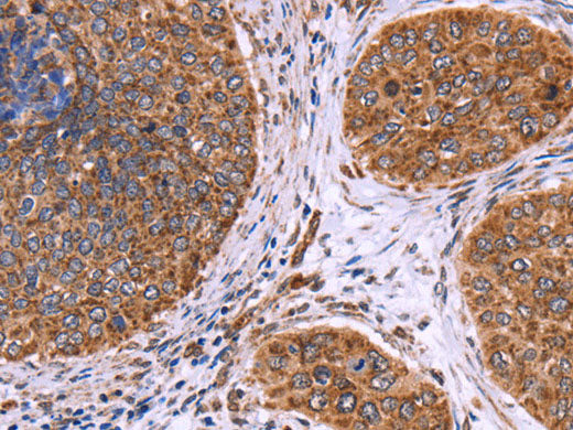CLUAP1 Polyclonal Antibody Store at -20°C