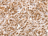 SUMO2/3/4 Polyclonal Antibody