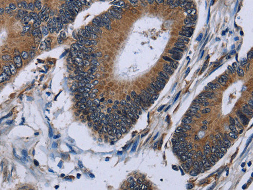 IPO4 Polyclonal Antibody Store at -20°C