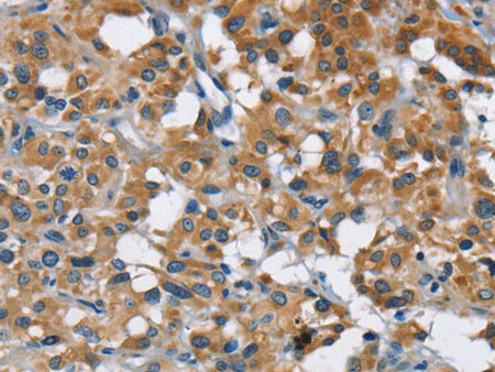 ANKHD1 Polyclonal Antibody Store at -20°C