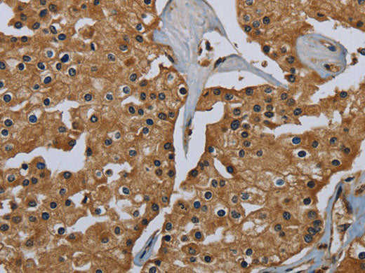 GBP5 Polyclonal Antibody