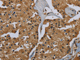 GBP5 Polyclonal Antibody