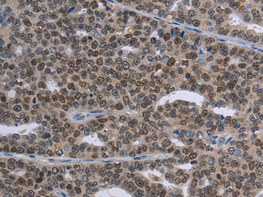 MAGEC1 Polyclonal Antibody Store at -20°C