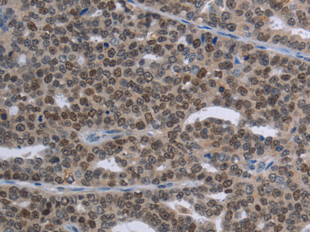 MAGEC1 Polyclonal Antibody Store at -20°C