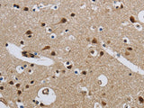CMTM8 Polyclonal Antibody