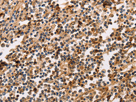 PPP1CB Polyclonal Antibody Store at -20°C