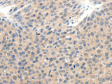 SCN10A Polyclonal Antibody