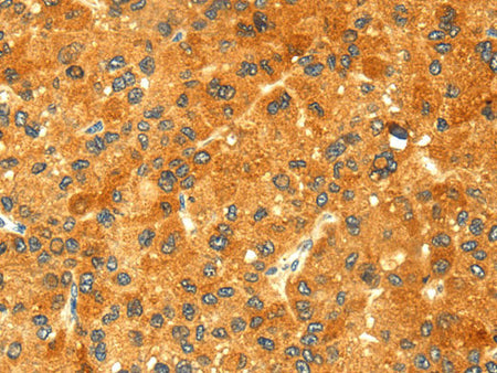GK1 Polyclonal Antibody Store at -20°C