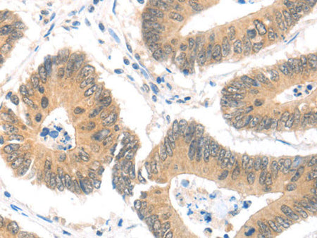 MAGED1 Polyclonal Antibody Store at -20°C