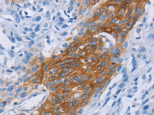 CCR9 Polyclonal Antibody Store at -20°C