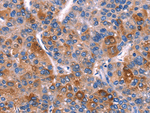 DUSP13 Polyclonal Antibody Store at -20°C