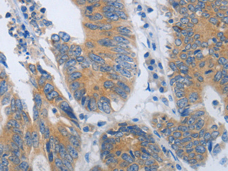 CD10 Polyclonal Antibody Store at -20°C