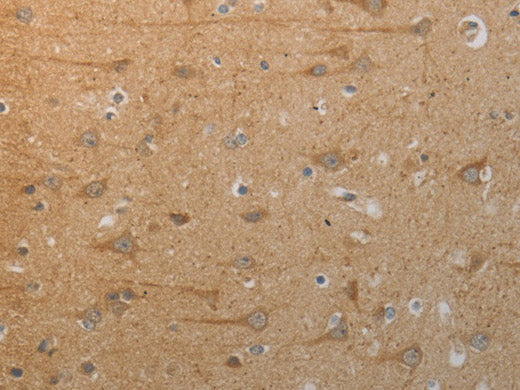 SLC4A7 Polyclonal Antibody