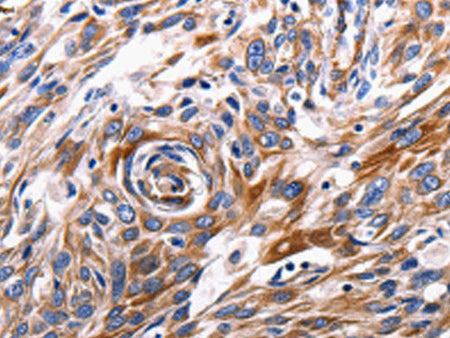 ACE2 Polyclonal Antibody Store at -20°C
