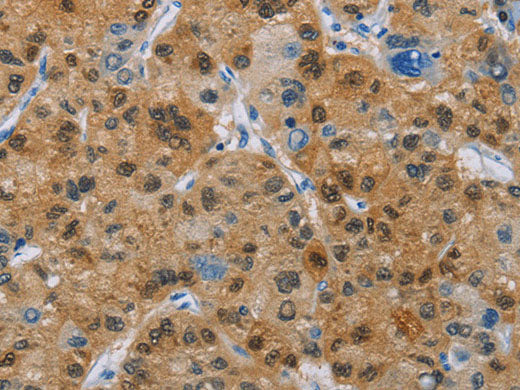 CD272 Polyclonal Antibody Store at -20°C