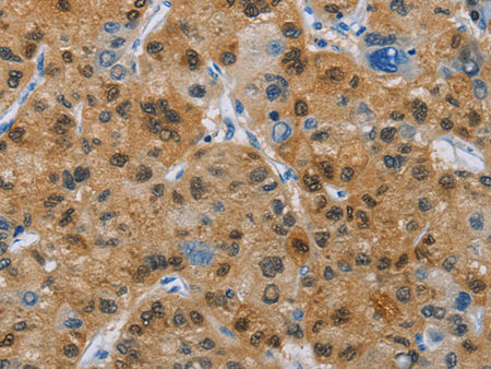 CD272 Polyclonal Antibody Store at -20°C