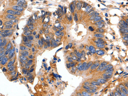 FADD Polyclonal Antibody Store at -20°C