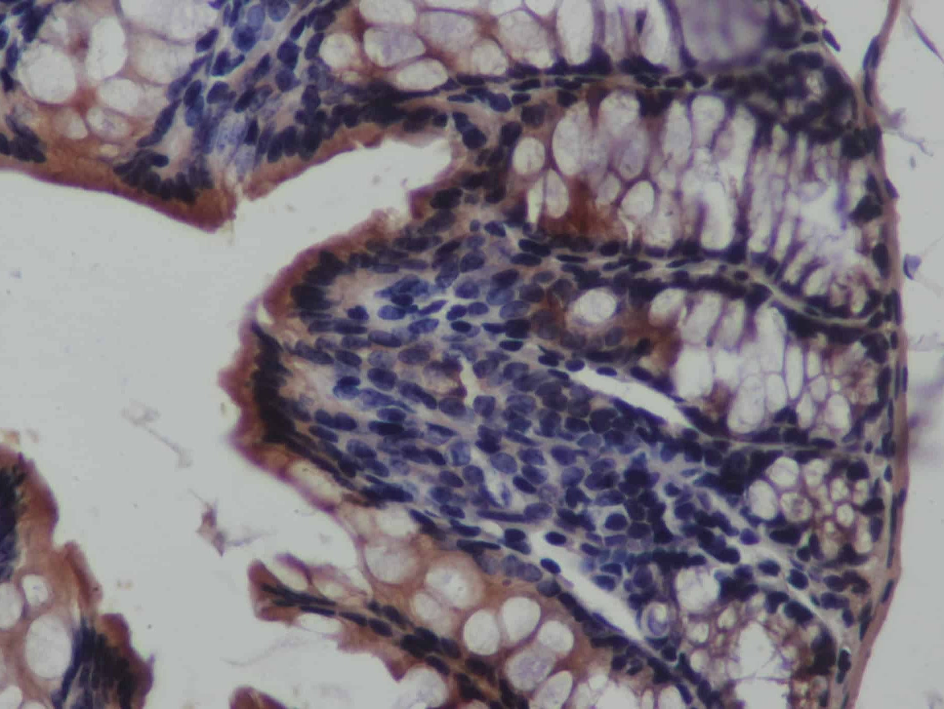 CK-19 Polyclonal Antibody Store at -20°C