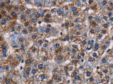 KCNK1 Polyclonal Antibody Store at -20°C