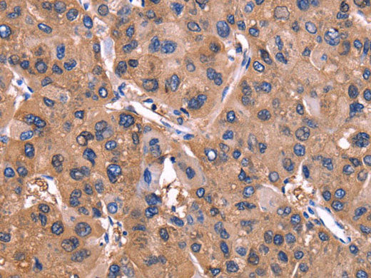 ADM2 Polyclonal Antibody