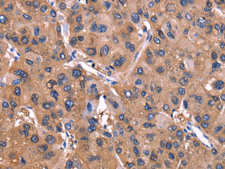 ADM2 Polyclonal Antibody