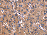 ADM2 Polyclonal Antibody