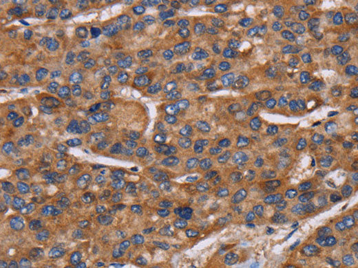 NCSTN Polyclonal Antibody Store at -20°C