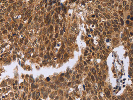 ERCC6L Polyclonal Antibody Store at -20°C