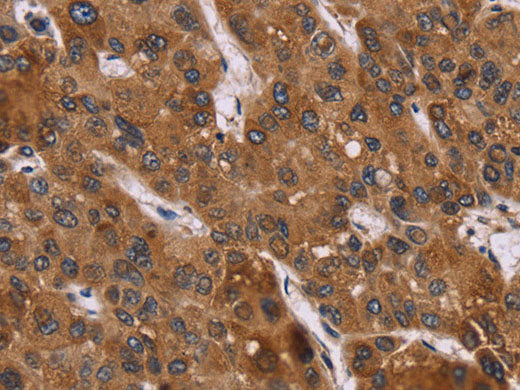 PPIB Polyclonal Antibody Store at -20°C