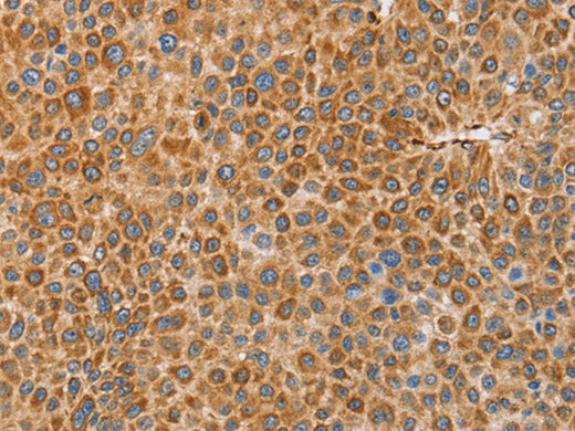 BRS3 Polyclonal Antibody Store at -20°C