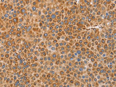 BRS3 Polyclonal Antibody Store at -20°C