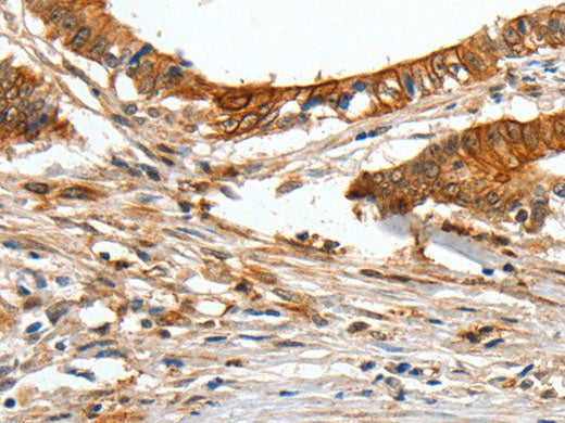 COL1A2 Polyclonal Antibody