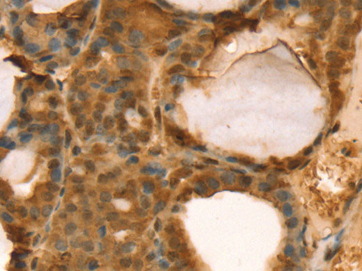 TAF11 Polyclonal Antibody Store at -20°C