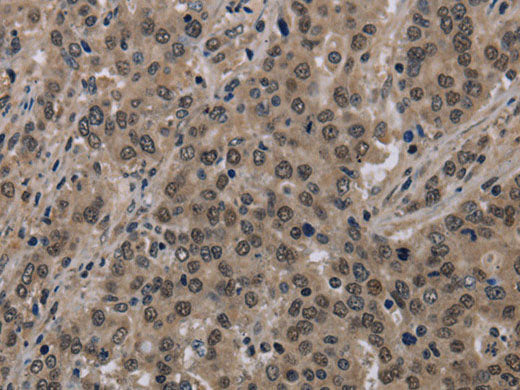 HIST1H2AH Polyclonal Antibody Store at -20°C