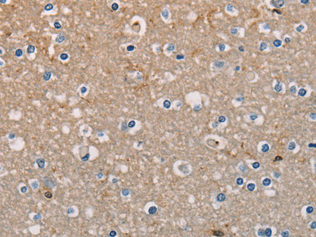 AMBRA1 Polyclonal Antibody