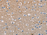 AMBRA1 Polyclonal Antibody